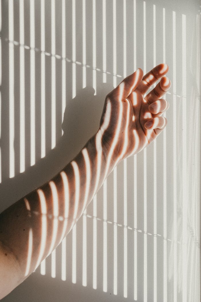 A human arm with striking shadow lines from window blinds, creating a unique pattern against a white background.